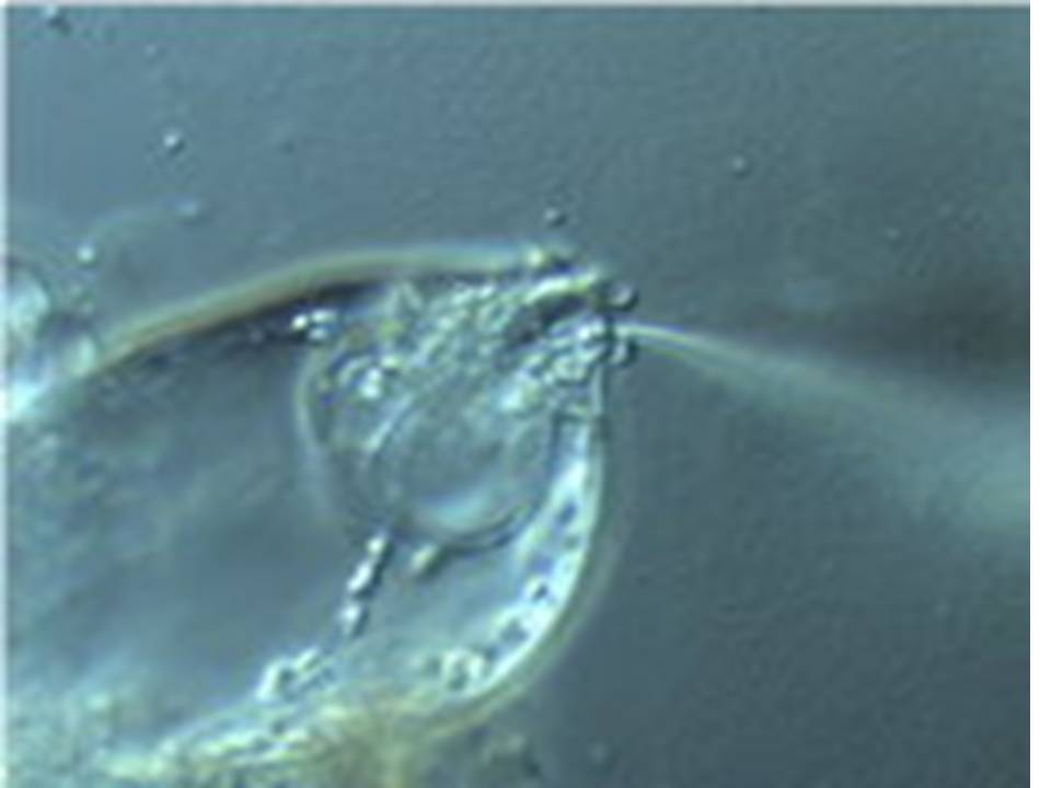 Injection of siRNA into the naked female gametophyte of Torenia1